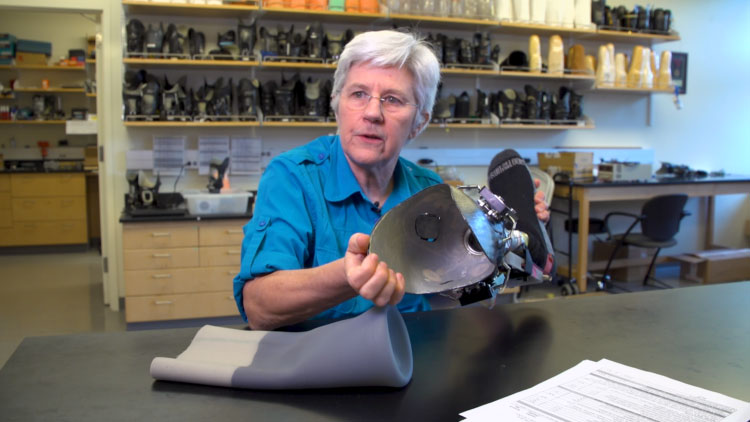 Finding the Perfect Fit for a Prosthetic Leg