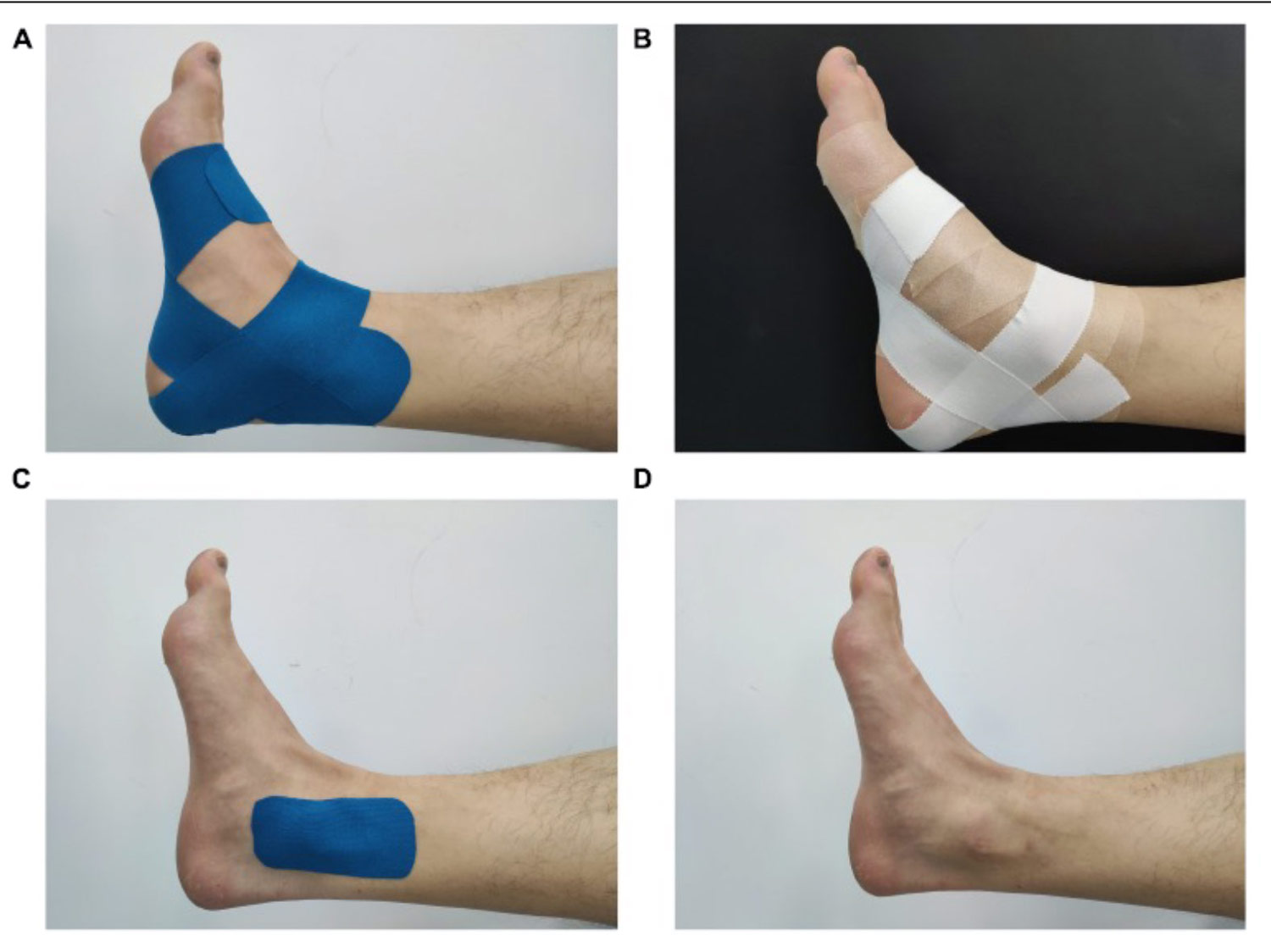 Effect of Kinesiology Tape on Muscle Activation in Chronic Ankle Instability