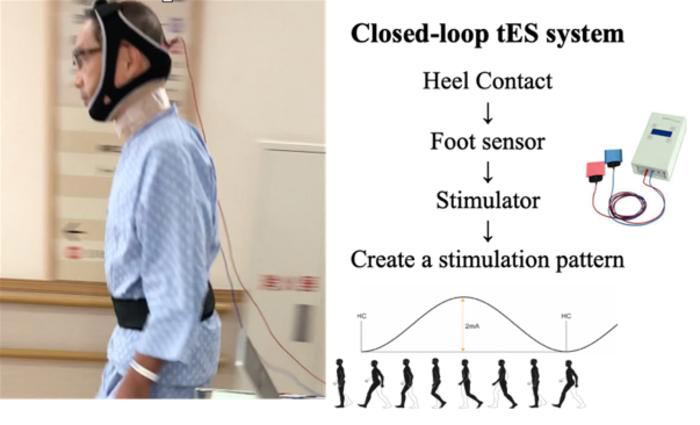 Brain Stimulation Improves Walking in Patients with PD