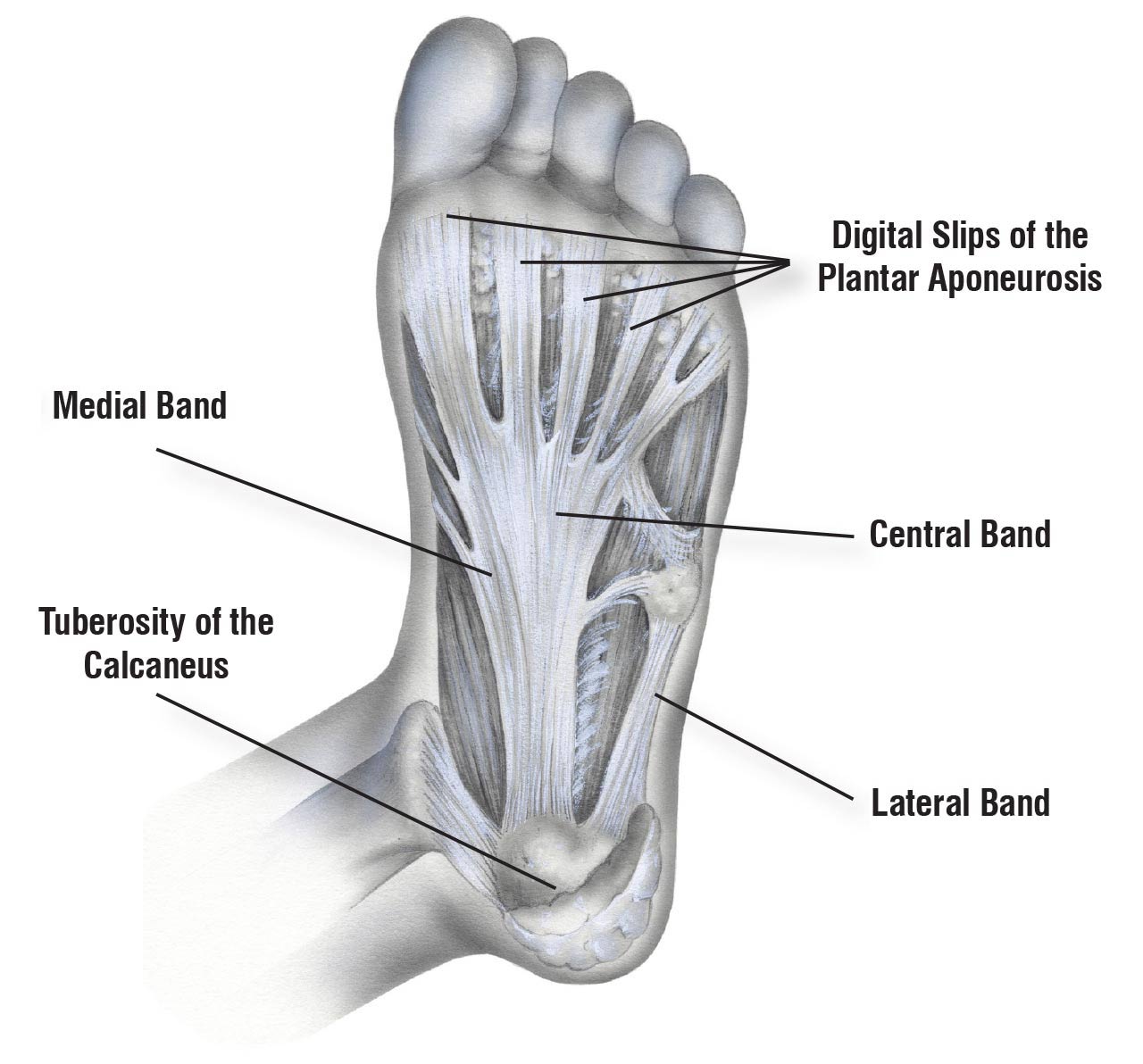 Do the Fasciae of the Soleus Have a Role in Plantar Fasciitis? Part I