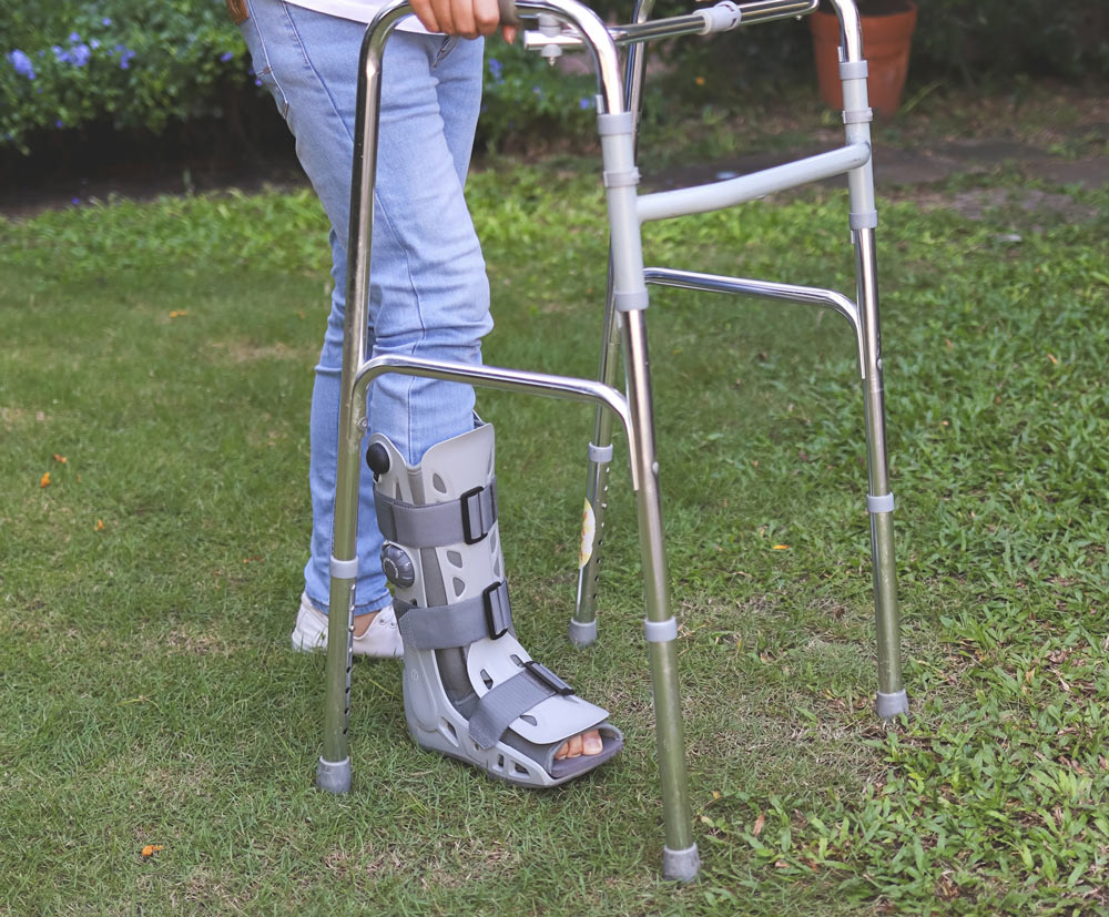 Use of Removable Boot vs Cast After Ankle Surgery: Cost-Effectiveness vs QoL   