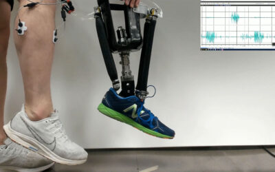 Robotic Prosthetic Ankles Improve Movement, Stability