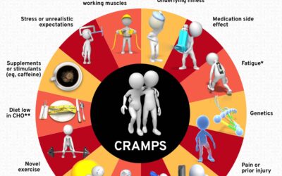 Understanding Exercise-Associated Muscle Cramps