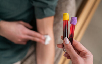 Blood Biomarkers for Knee Osteoarthritis