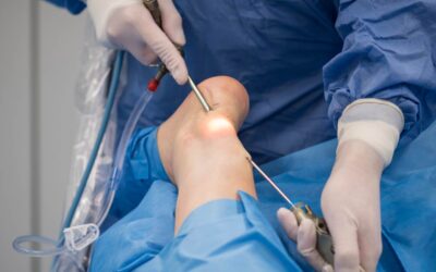 Surgical Management of Chronic Achilles Tendon Rupture: Evidence‑based Guidelines