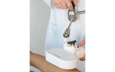 Noninvasive Magnetic Peripheral Nerve Stimulation for PDN