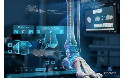 Surgical Navigation System for TAA