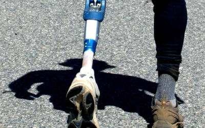 Swiss Prosthetic Leg Helps Amputees to Feel the Floor