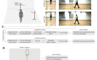Cell Phone Video Technology Unveils New Method for Gait, Walking Analysis