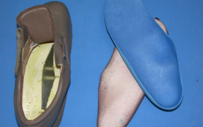 Relasting as an Alternative to Custom Shoes