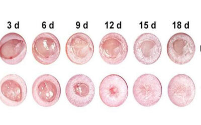 Nano Drug Accelerates Diabetic Wound Healing in Mice