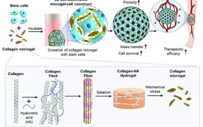 Stem Cell Therapy Aims to Prevent Amputations from CLI