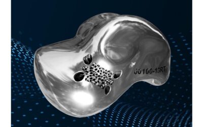 Patient-specific Talus Replacement