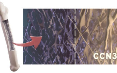 Maternal Brain Hormone Strengthens Bones, Could Treat Osteoporosis, Bone Fractures