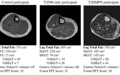 Visualizing Declining Muscle Quality