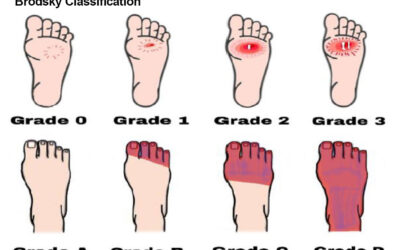 Factors Influencing Wound Healing in Diabetic Foot Patients