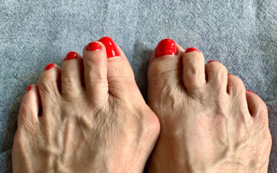 lerEXPO Conversations: Facts, Fictions, Fallacies of the Lapidus Bunionectomy