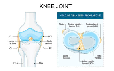 Recent Prior Corticosteroid Injections Increase Meniscus Repair Failure