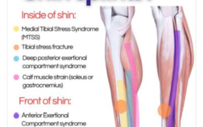 LinkedIn Post of the Month