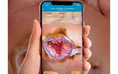 Application for Wound Care