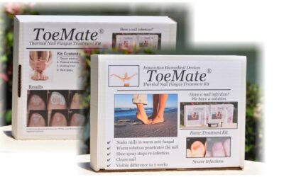 Thermal Nail Fungus Treatment