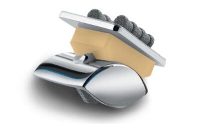 Total Ankle Replacement System