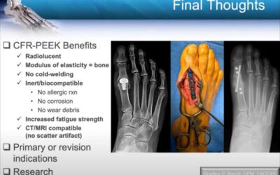 LEREXPO Conversations: Emerging Radiolucent Technologies and Bone Grafting Techniques