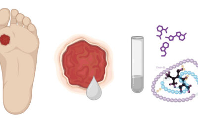 Combination of Diabetes Drugs Show Promise for Healing DFUs