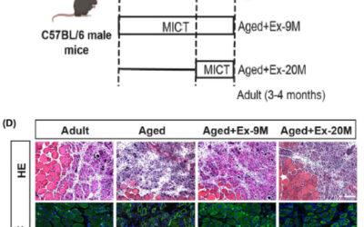 Aerobic Exercise Boosts Muscle Regeneration in Aged Mice
