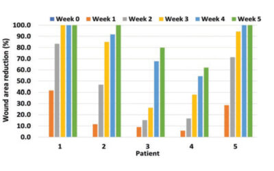 Continuous Topical Oxygen Therapy for Wound Care