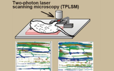 Microvascular Permeability in Diabetic Muscle
