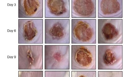 D-mannose promotes diabetic wound healing in rats