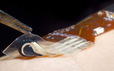 Flexible Skin Sensor Detects Biomarkers, Offers Hope for Noninvasive Disease Monitoring