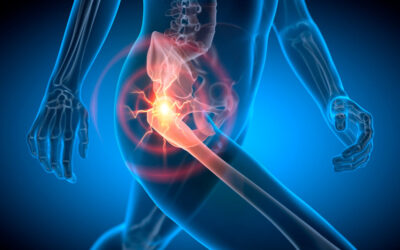 THA/TKA Improves Spouses Quality of Life Too!