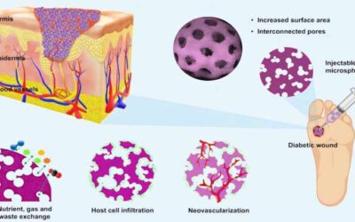 Promising New Treatment for Diabetic Wounds