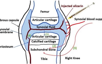 Tool Listens in on Early OA Biochemical Communication in Joints