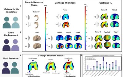 qMRI Biomarkers for OA & Knee Replacement