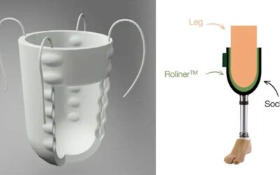 New Material Allows Adjustments to Prosthetic Limb Fit Throughout the Day Via Smartphone