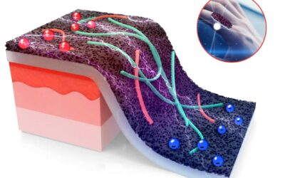 Smart Sensor Takes the Pain Out of Wound Monitoring