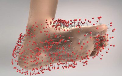 Low-Intensity Focused Ultrasound for Pain Relief in DPN?