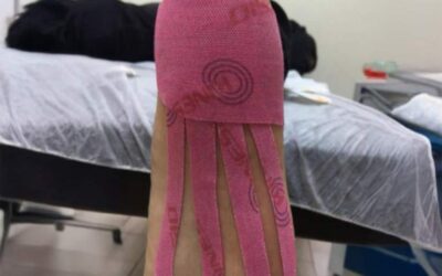 Does Kinesio Tape Negatively Affect Treatment of Plantar Fasciitis