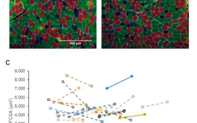 Study Shows Older Sprinters Lose Force Generating Capacity
