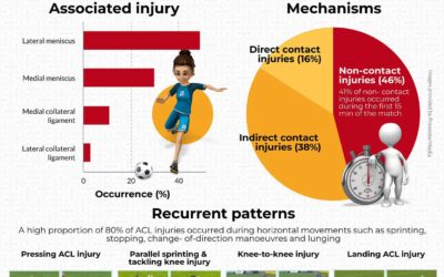Patterns of ACL injury in women’s football
