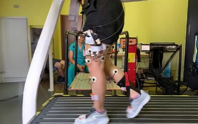 Reducing Muscle Spasticity in Incomplete SCI Patients