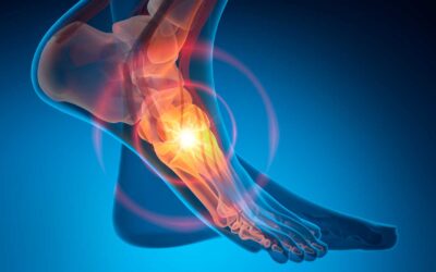 Building Core Outcome Set for Foot & Ankle in Rheumatic and Musculoskeletal Diseases