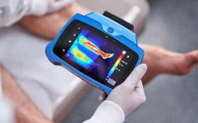 Thermal Imaging Module for MolecuLightDX