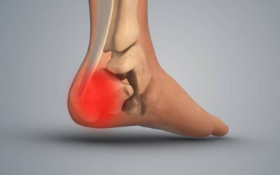 Suture Method Matters in Knee Arthroscopy for Meniscus Repair
