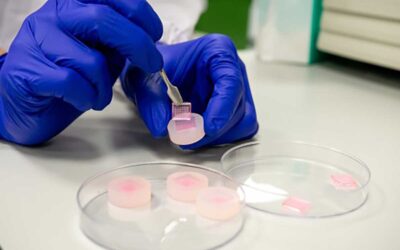 Microneedle Technologies May Accelerate Diabetic Wound Healing