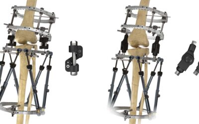 Circular Frame Hinges for Knee, Ankle Applications