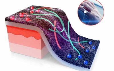 Smart Sensor Developed to Monitor Wounds